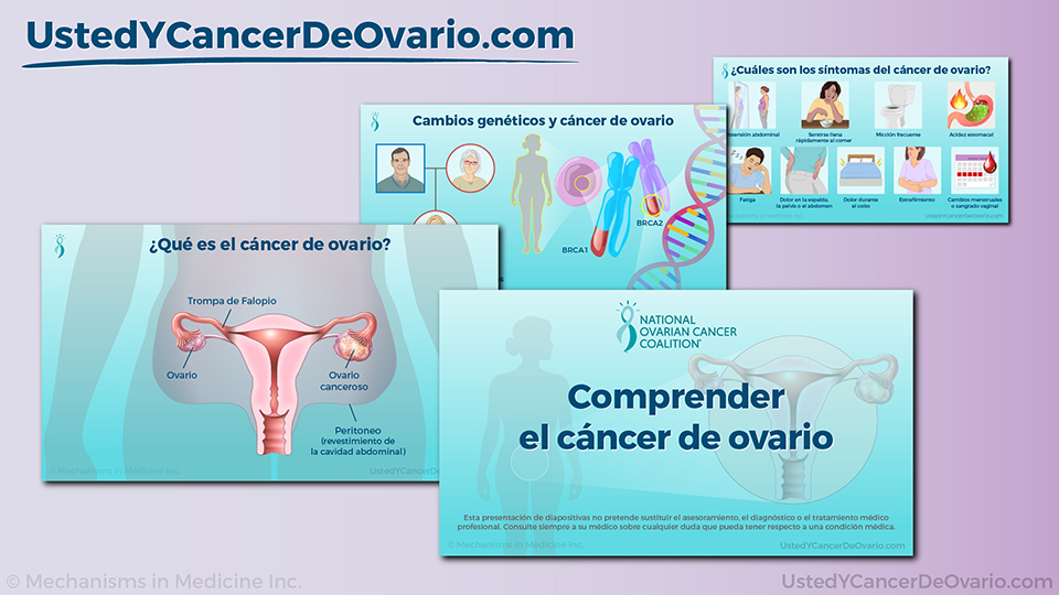 Comprender el cáncer de ovario