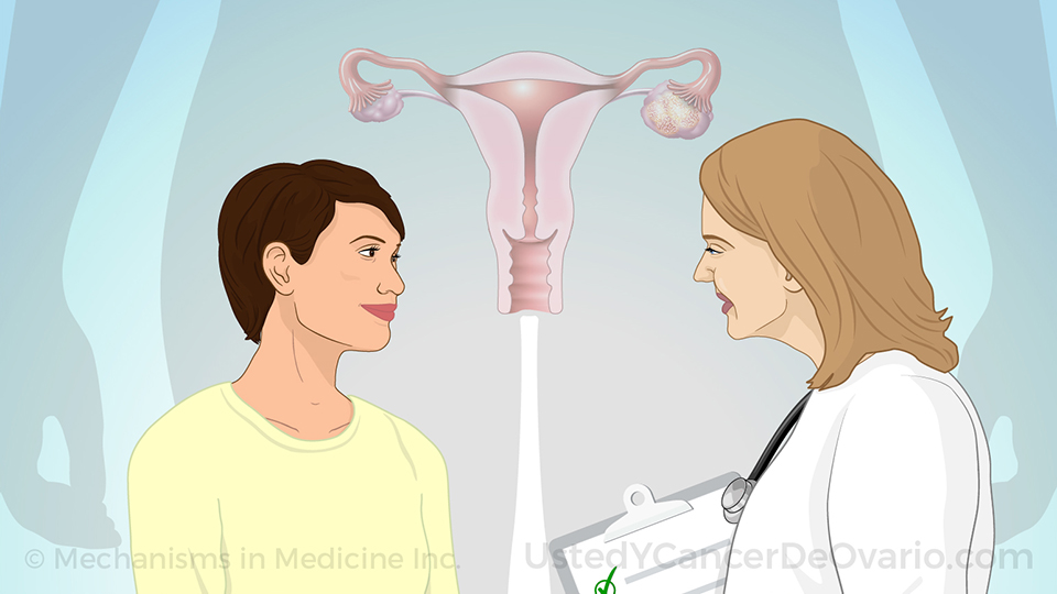 Animación - Comprender el cáncer de ovario