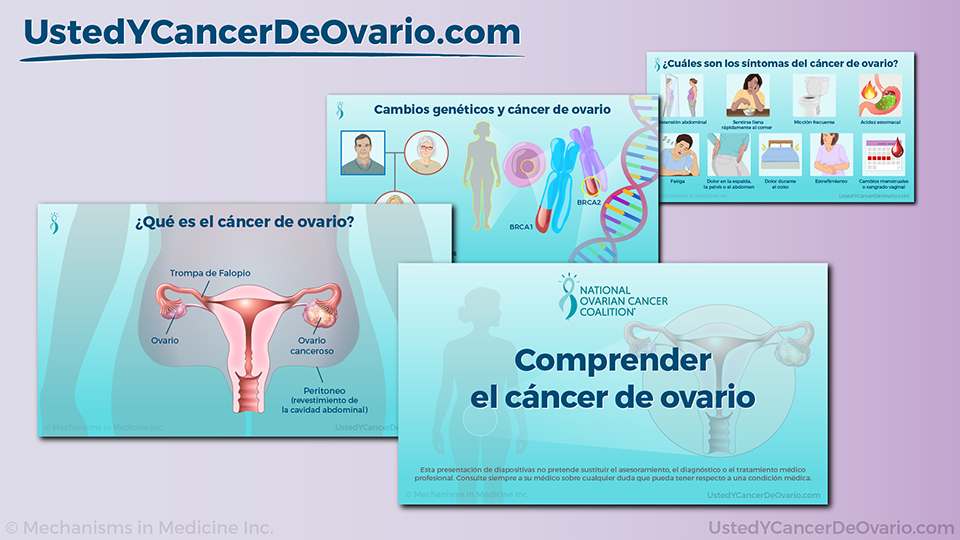Presentación de diapositivas - Comprender el cáncer de ovario