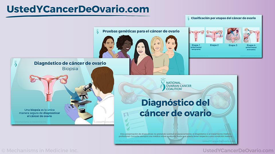 Presentación de diapositivas - Diagnóstico del cáncer de ovario