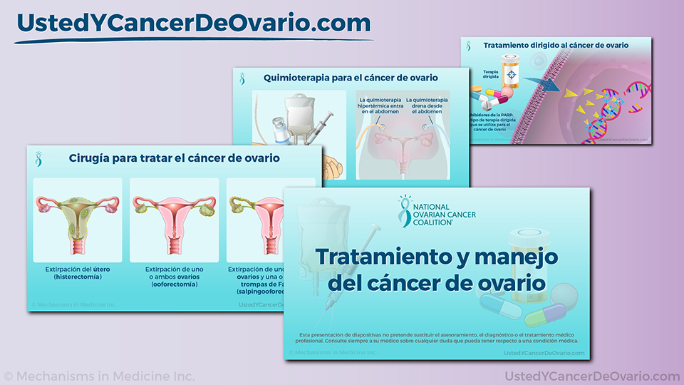 Tratamiento y manejo del cáncer de ovario