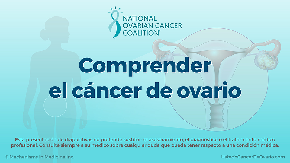 Comprender el cáncer de ovario