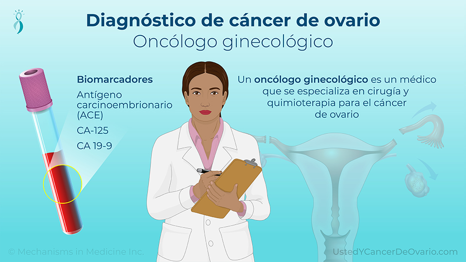 Diagnóstico de cáncer de ovario (Oncólogo ginecológico)