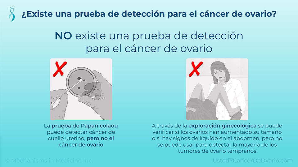 ¿Existe una prueba de detección para el cáncer de ovario?