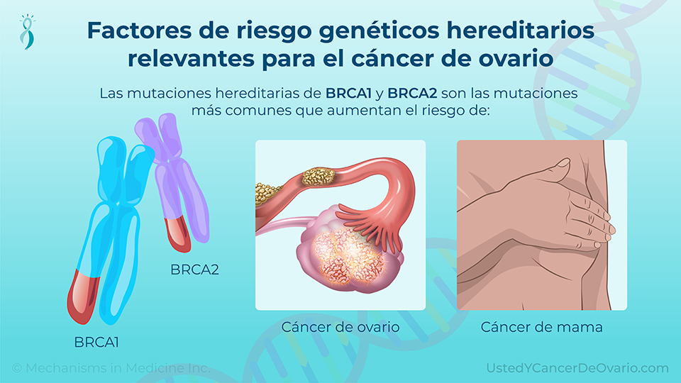 Factores de riesgo genéticos hereditarios relevantes para el cáncer de ovario
