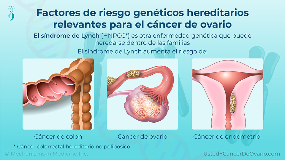 Factores de riesgo genéticos hereditarios relevantes para el cáncer de ovario